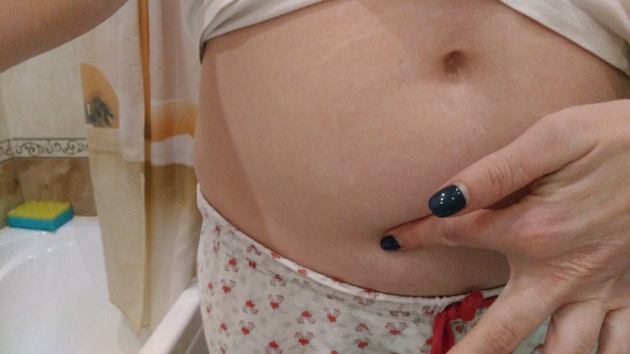 Sinais de infecção por helmintos por experiência pessoal