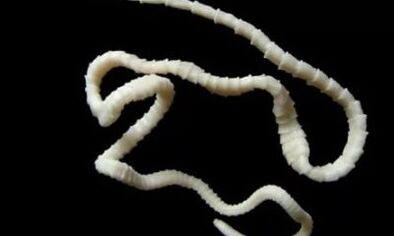 como remover o parasita cestóide do corpo