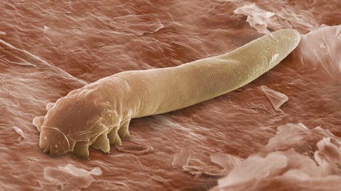 Parasita subcutâneo sob um microscópio