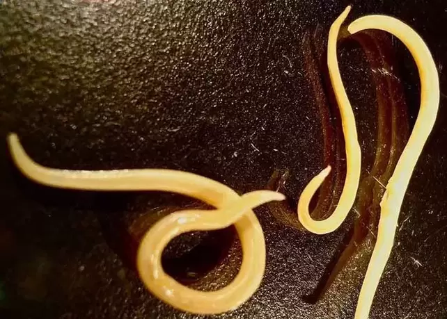 parasita protozoário do corpo humano